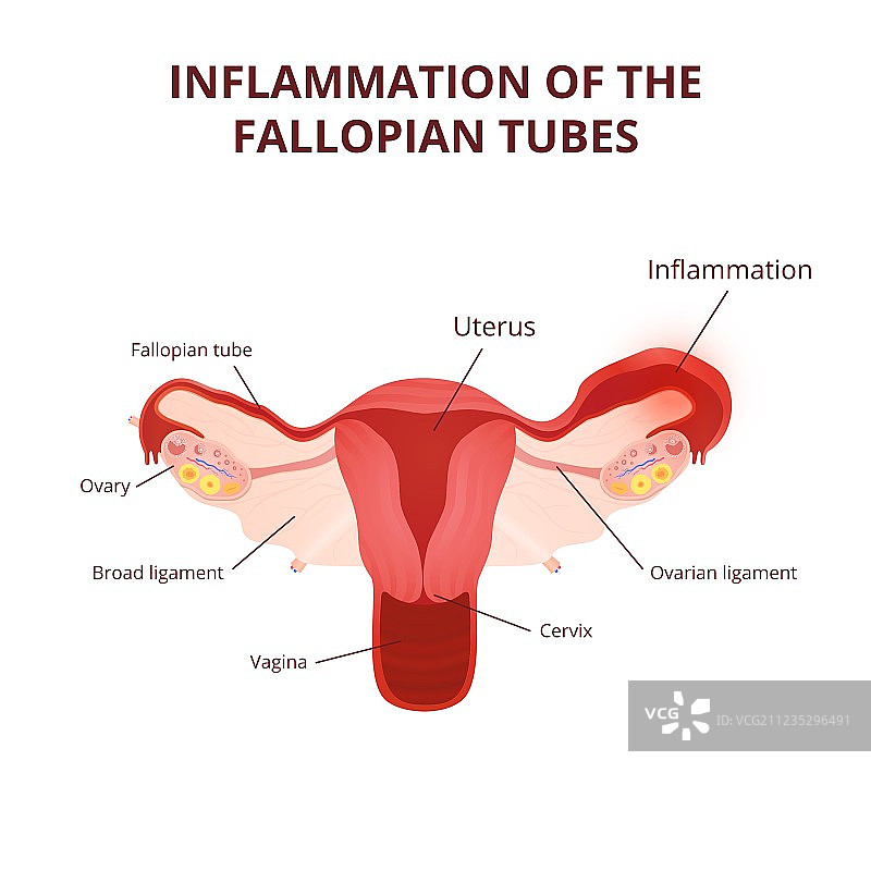 女性生殖系统图片素材