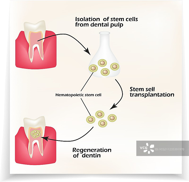牙齿牙本质干细胞的用途图片素材