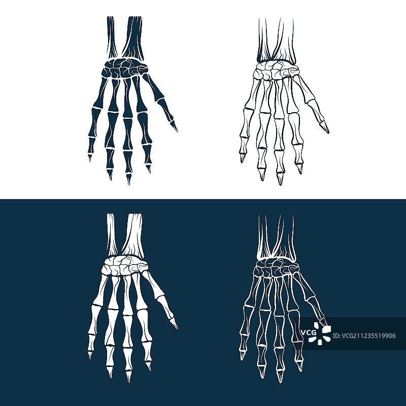 手骨骼合集图片素材
