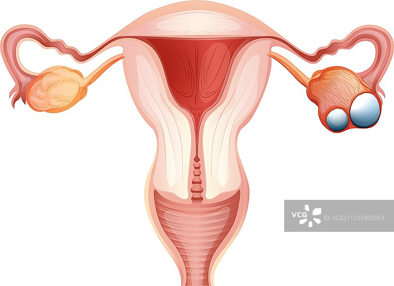 女性卵巢癌图解图片素材