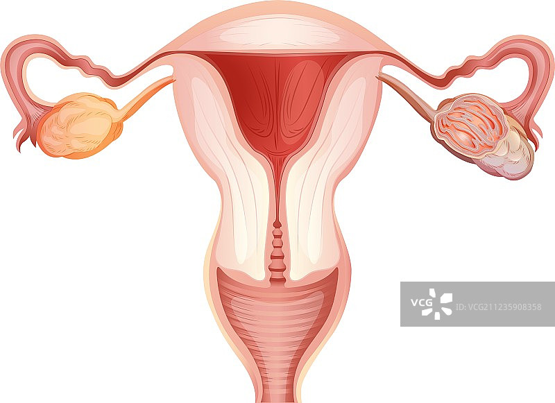 女性卵巢癌图片素材