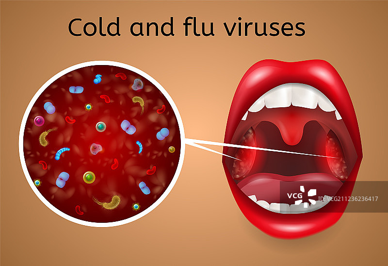 感冒和流感病毒症状概念图片素材