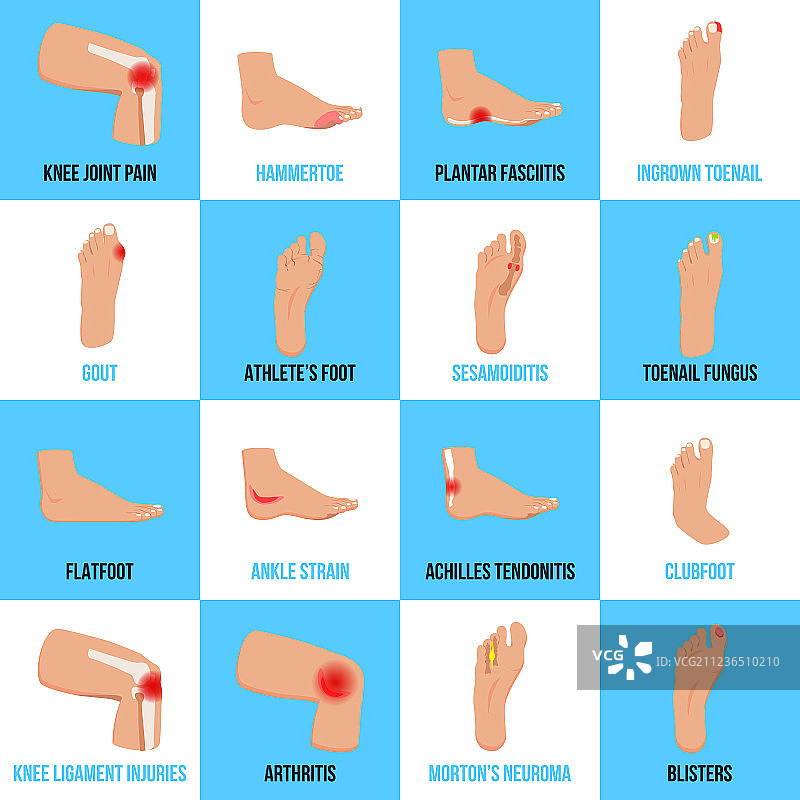 足部问题扁平图标集图片素材