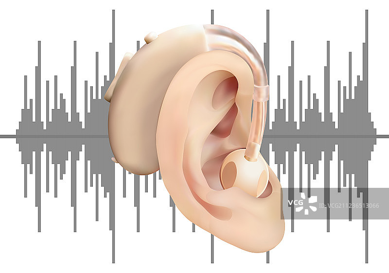 耳背式数字助听器图片素材
