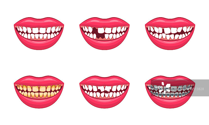 逼真的3D牙齿问题模型图片素材