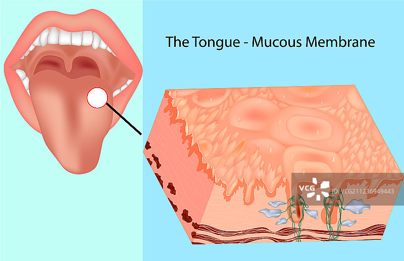 口腔黏膜图片素材