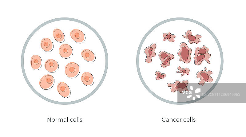 正常细胞与癌细胞结构图片素材