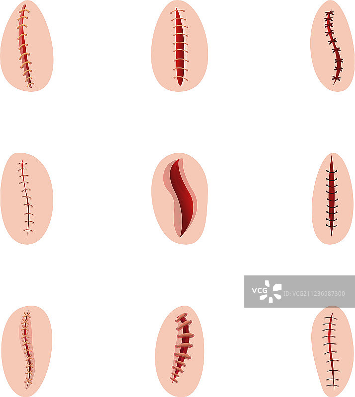 手术缝合线卡通风格图标集图片素材