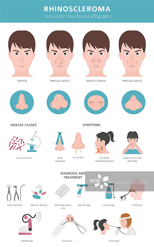 鼻部硬结病症状图片素材