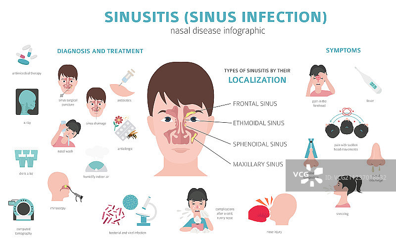 鼻部疾病：鼻窦炎和鼻窦感染图片素材