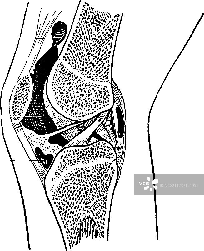 膝关节骨骺线（老式风格）图片素材