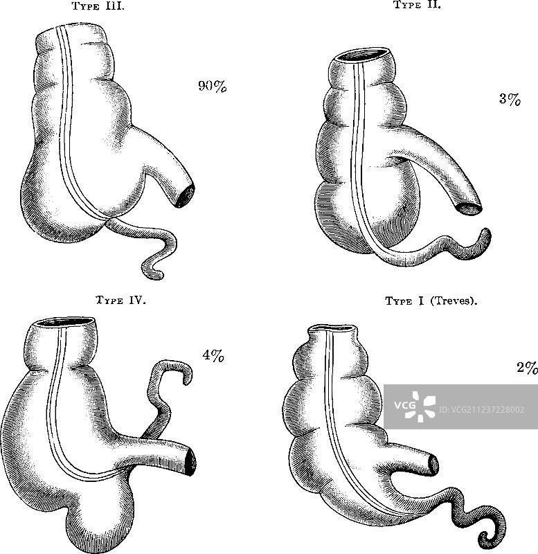 四种盲肠复古图图片素材