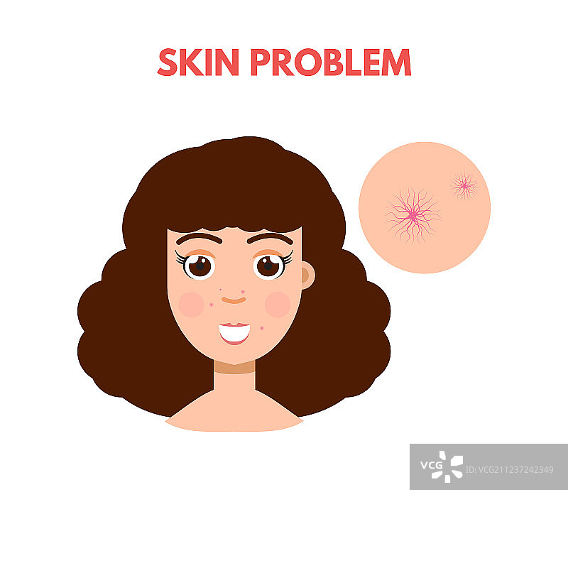 有皮肤问题的女人图片素材