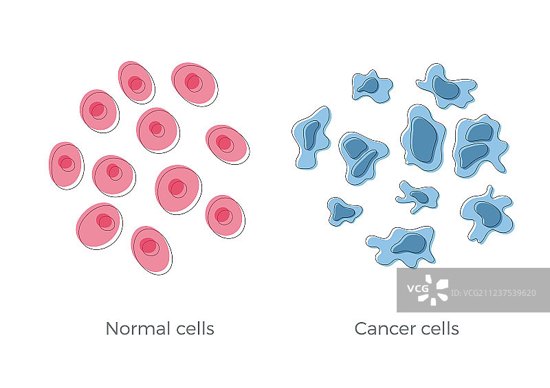 细胞结构正常和癌变图片素材