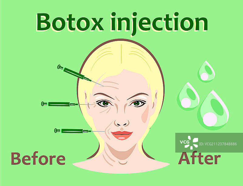 美容手术肉毒杆菌图片素材