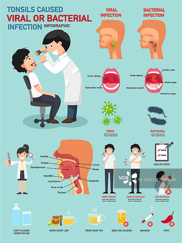 病毒或细菌感染引起的扁桃体炎图片素材