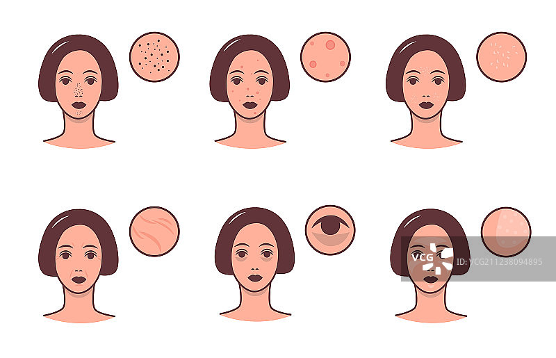 具有不同皮肤状况的女性面部合集图片素材