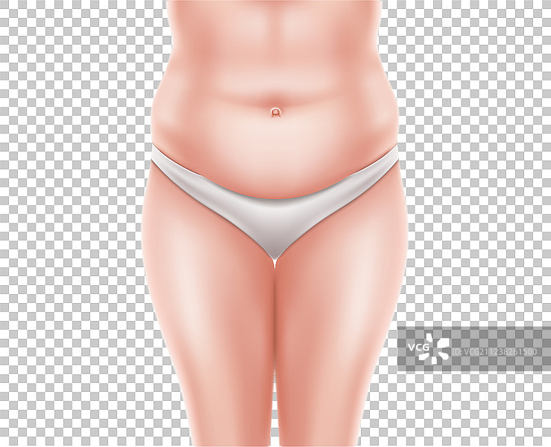 吸脂手术前后对比（女性）3D效果图片素材