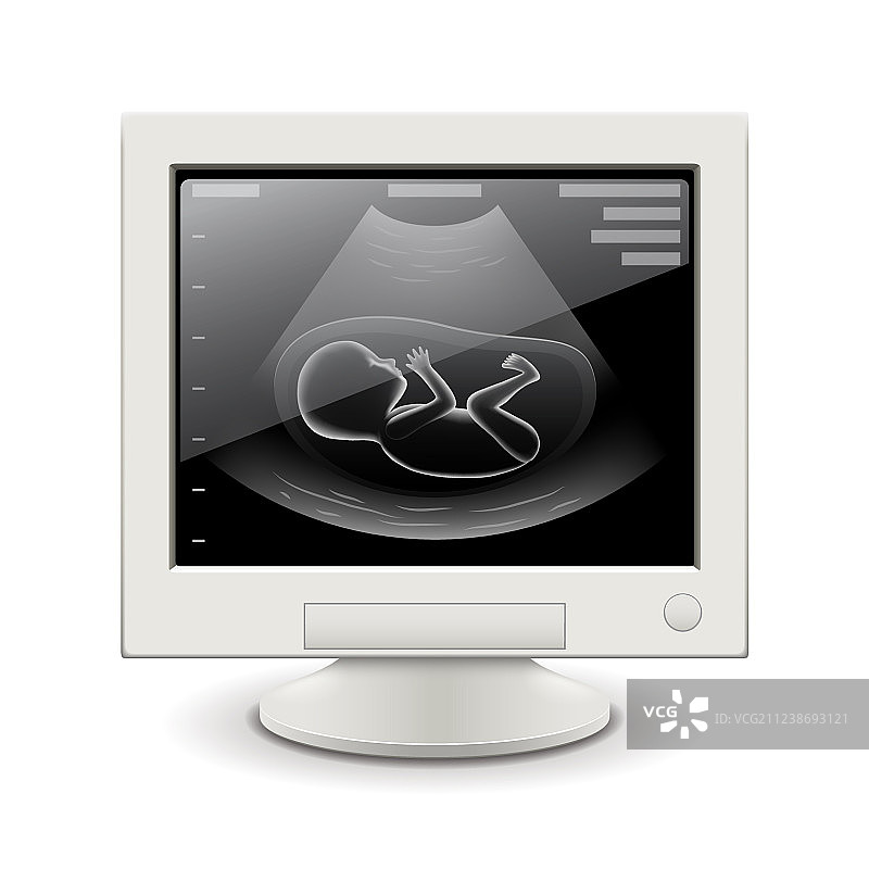 白色背景上的妊娠超声波屏幕图片素材