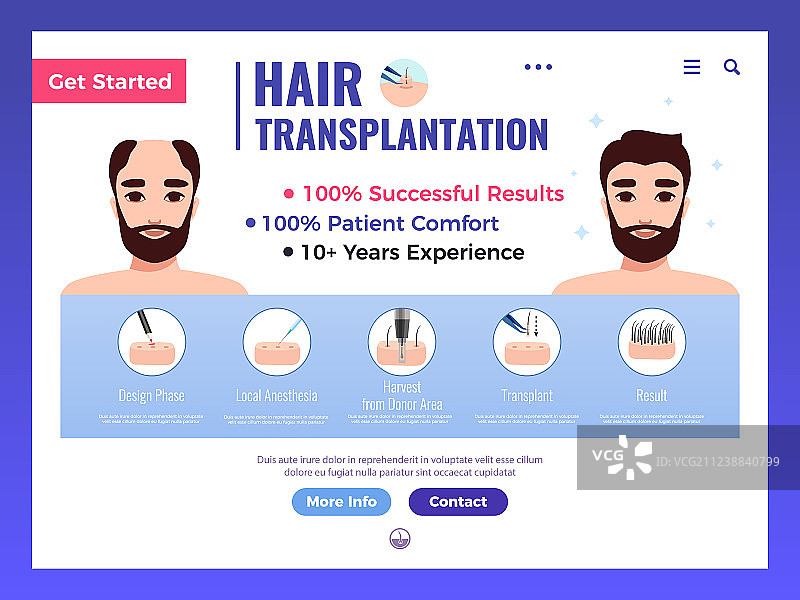 头发移植网页banner图片素材