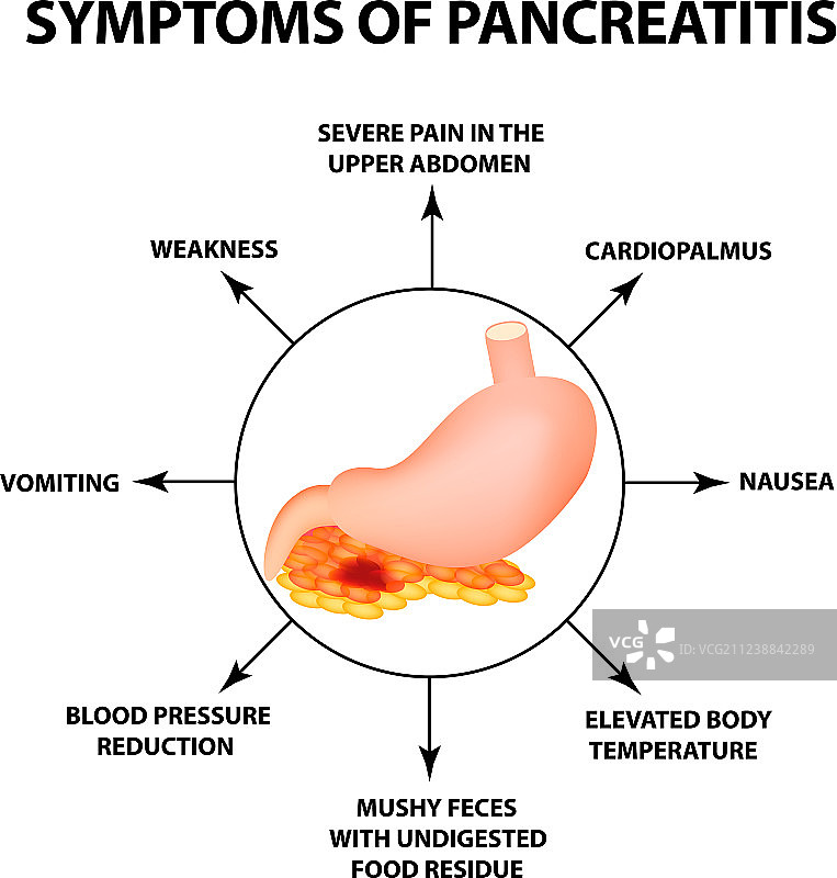 胰腺炎的症状结构图片素材