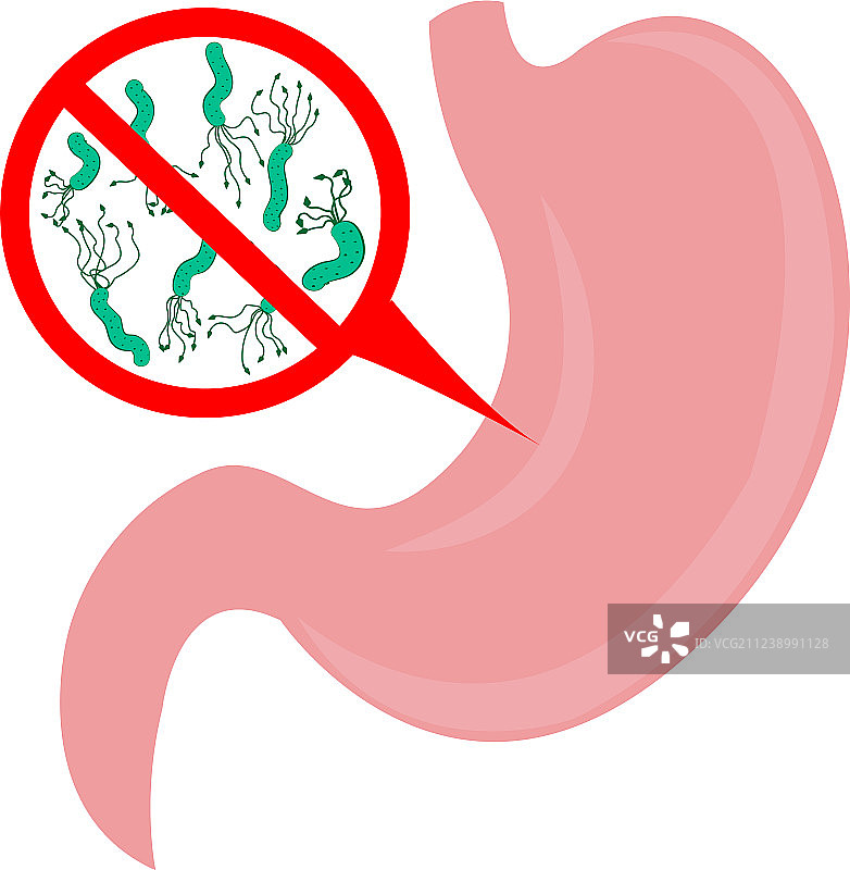 停止胃中幽门螺杆菌标志图片素材