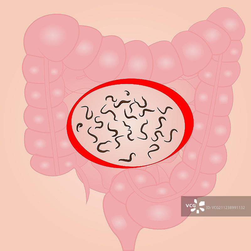 小肠内的蠕虫图片素材