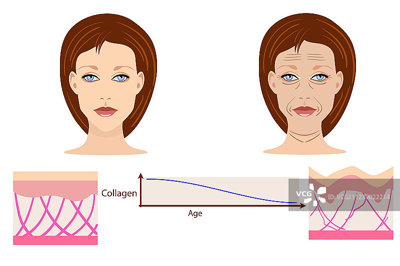 人脸与两种类型的皮肤：老化图片素材