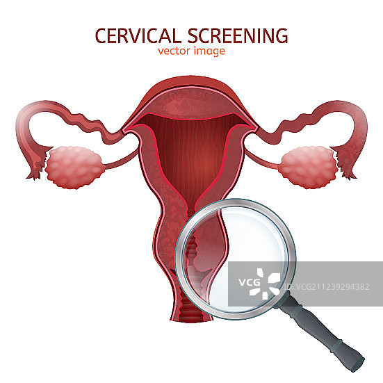 宫颈癌筛查图像图片素材