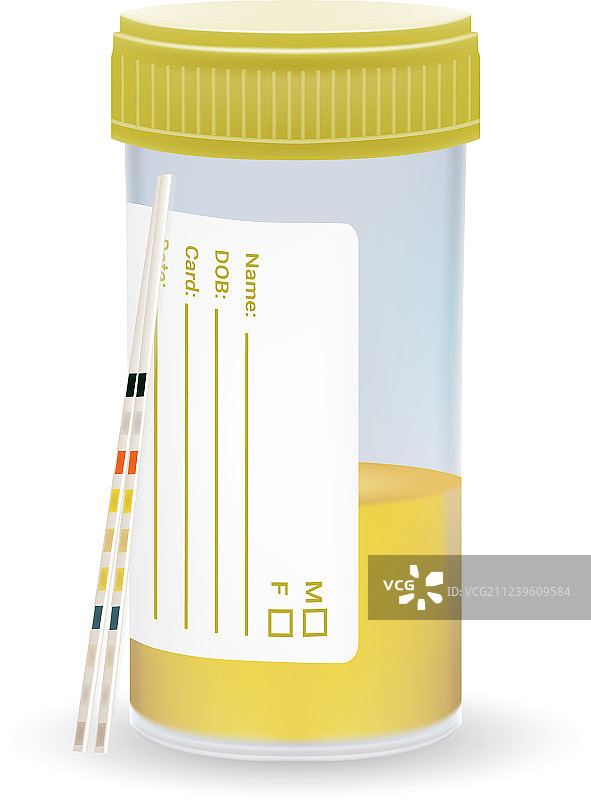 PH试纸石蕊试纸和测试瓶中的尿液图片素材