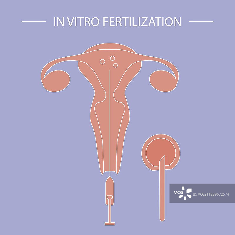 体外受精宣传单图片素材
