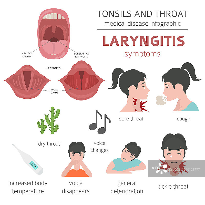 扁桃体和咽喉疾病喉炎症状图片素材