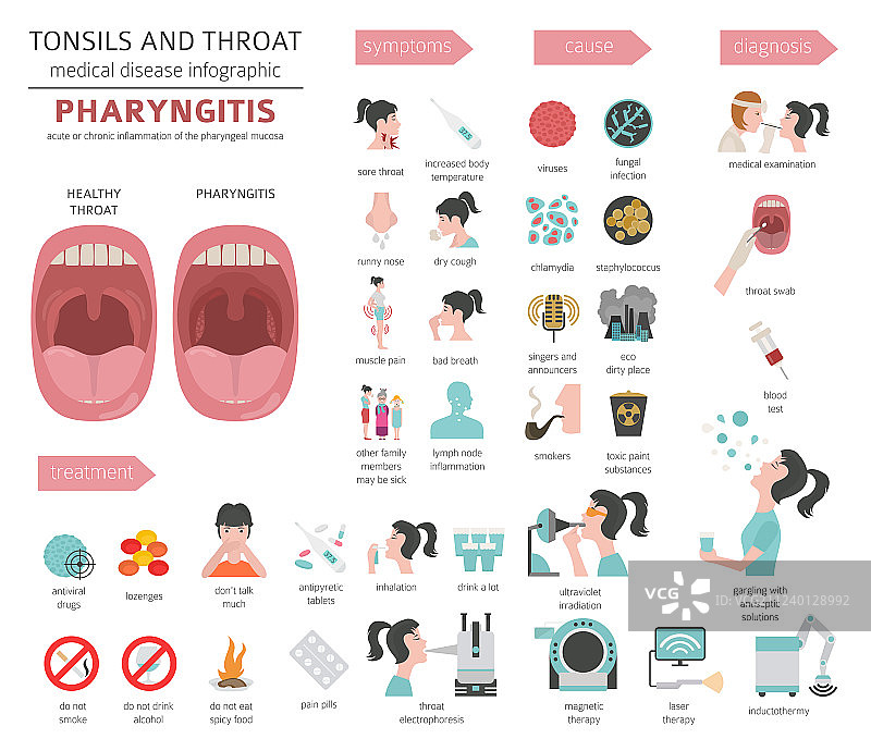 扁桃体和咽喉疾病咽炎症状图片素材
