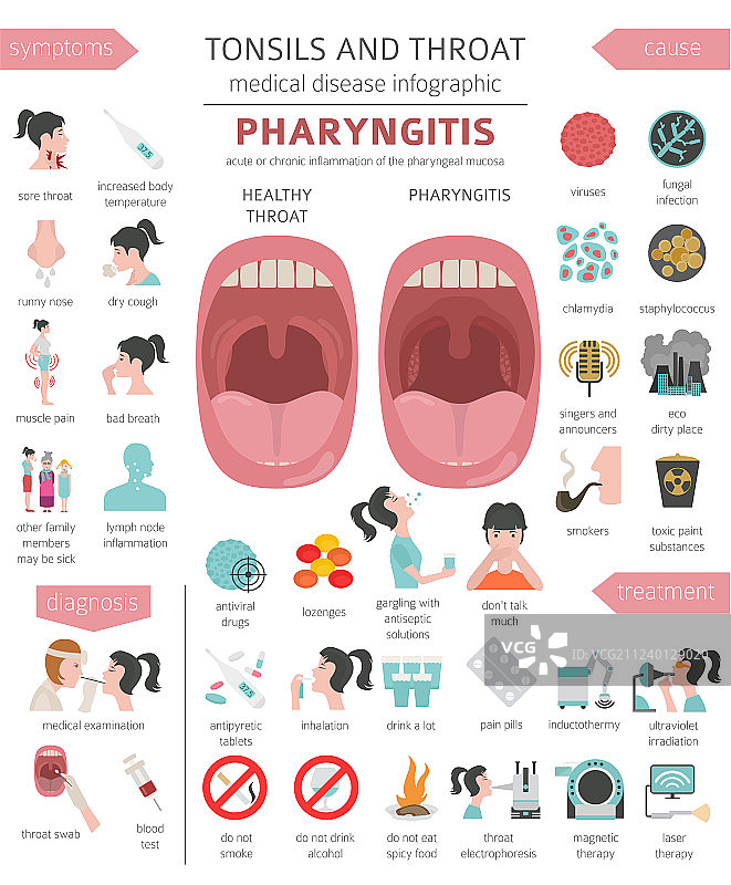 扁桃体和咽喉疾病咽炎症状图片素材