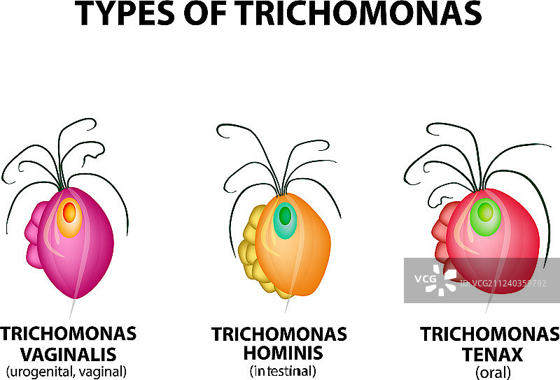 阴道毛滴虫图片素材