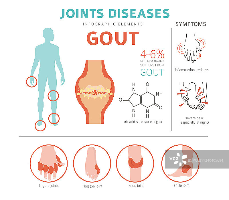 关节疾病痛风症状治疗图标集图片素材