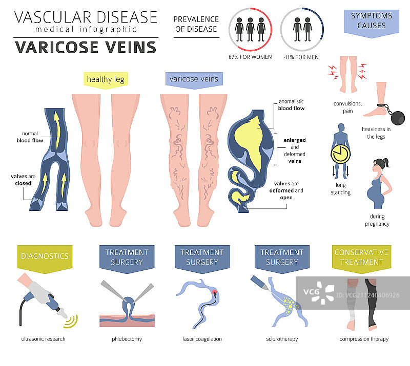 血管疾病静脉曲张症状图片素材