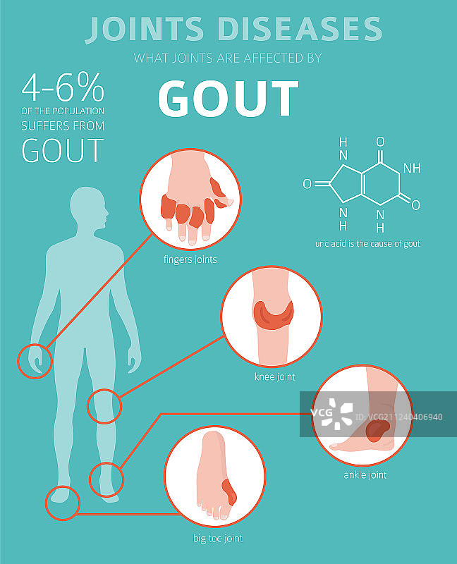 关节疾病痛风症状治疗图标集图片素材