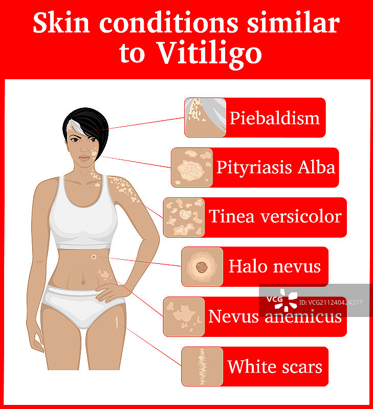 具有外部相似性的皮肤状况图片素材