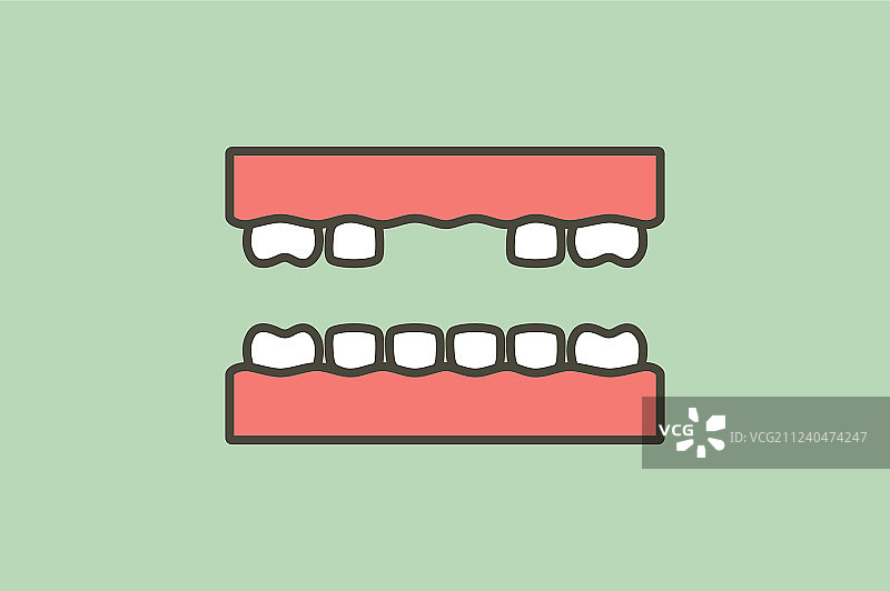 牙齿之间的缺牙图片素材