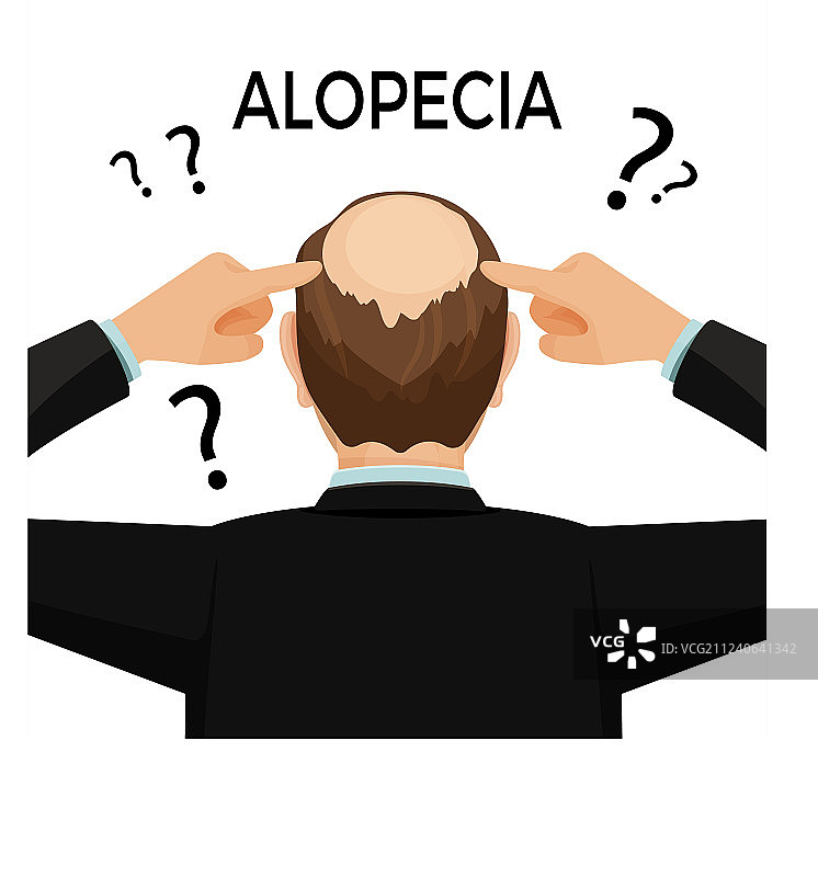 脱发概念：男子展示脱发后颈图片素材