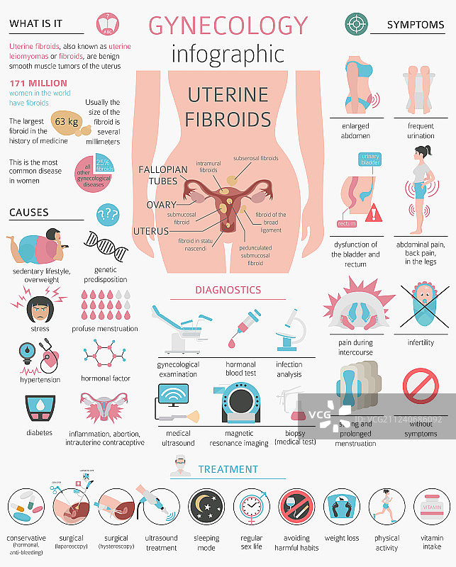 子宫肌瘤妇科医学疾病图片素材