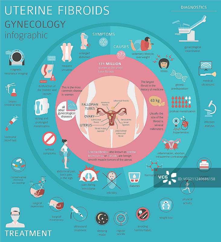 子宫肌瘤妇科医学疾病图片素材