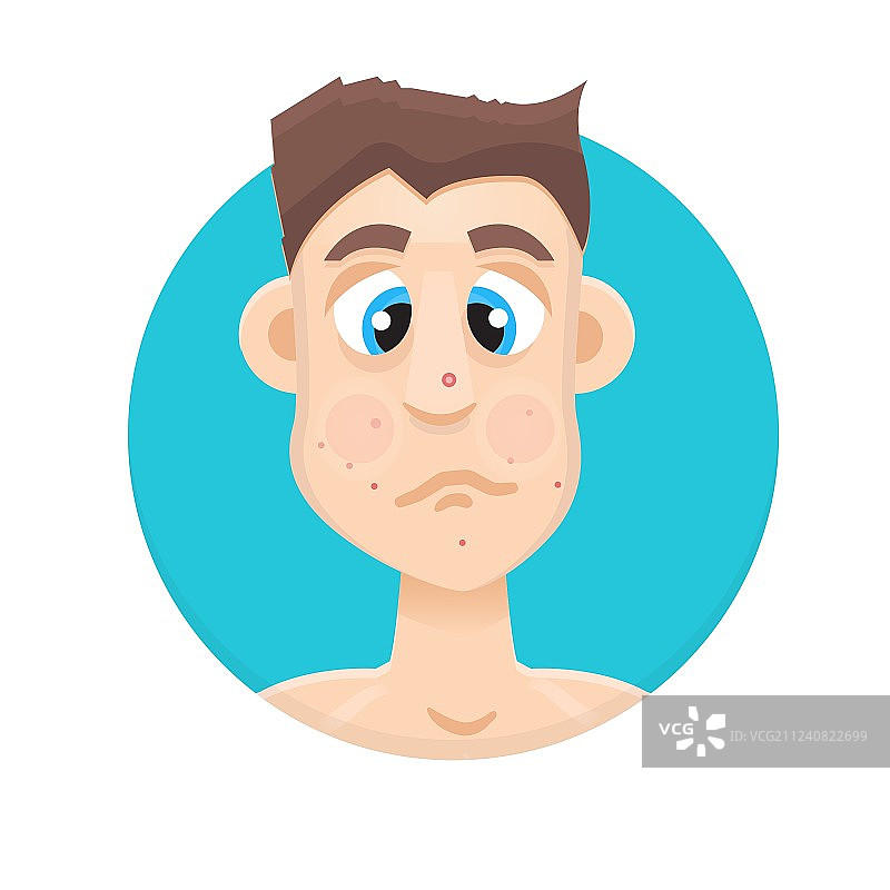 长痤疮的男人图片素材