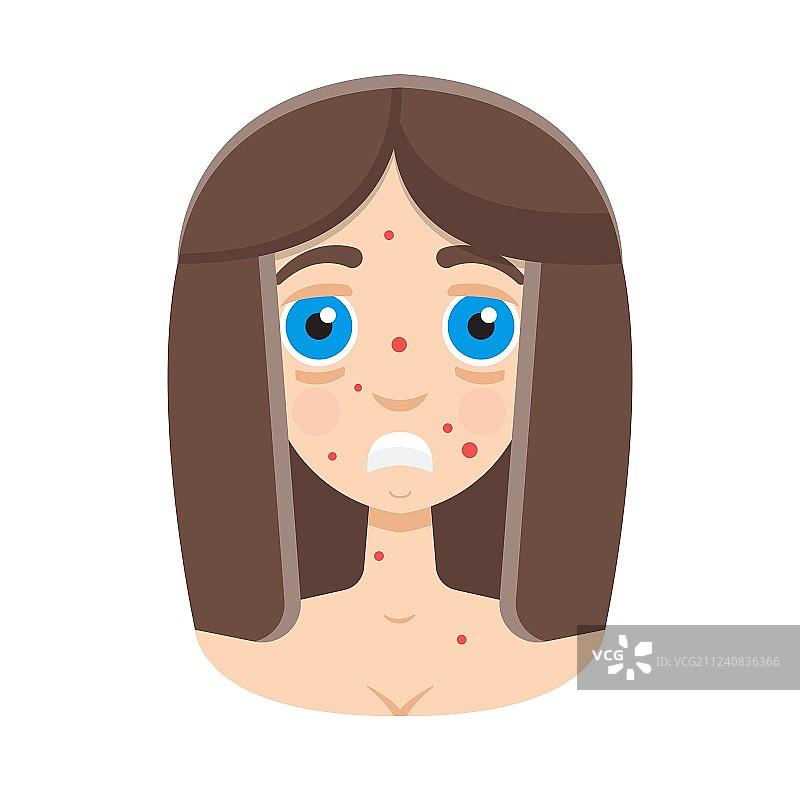 长粉刺的女孩图片素材
