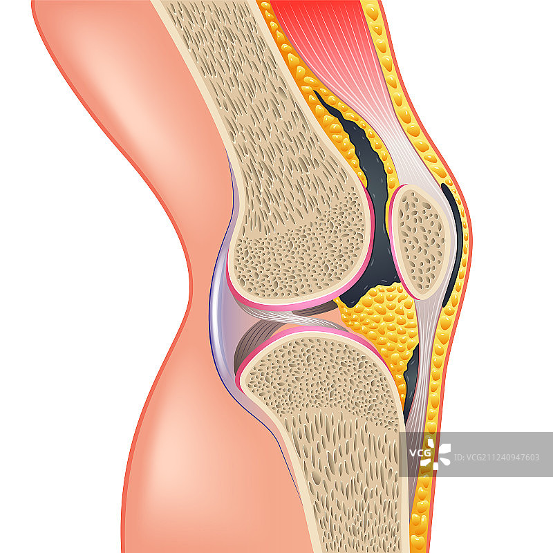 白色背景上的膝关节解剖图图片素材