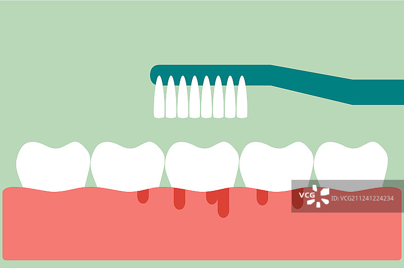 刷牙时牙龈和牙齿出血图片素材