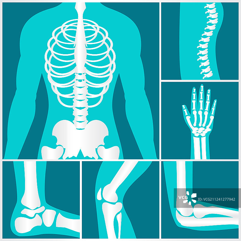 人体骨骼X光片合集图片素材