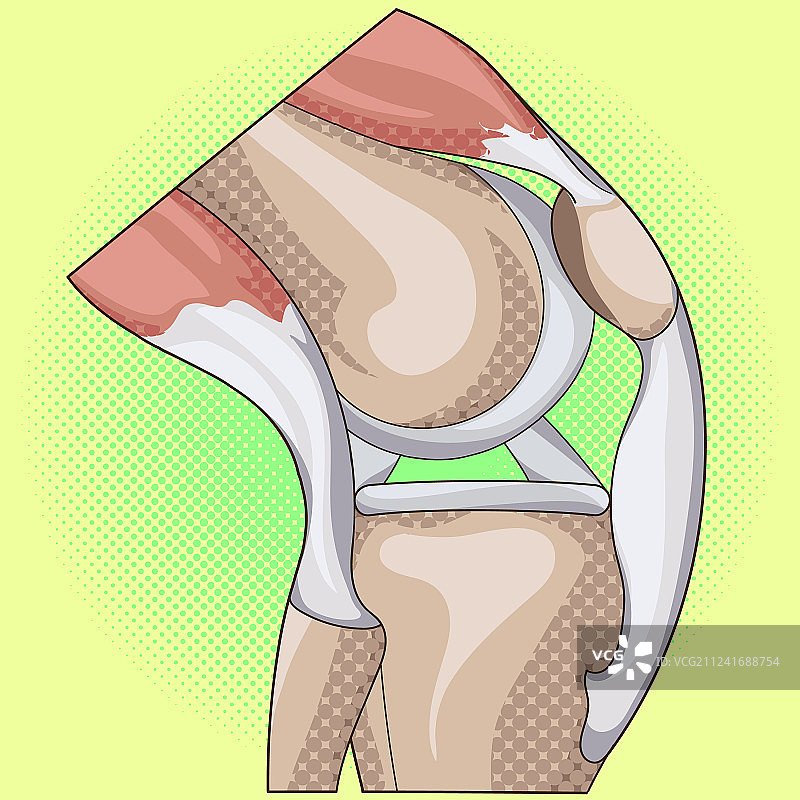 膝关节的解剖结构波普艺术图片素材