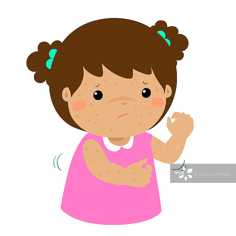 女孩挠身体上发痒的皮疹图片素材
